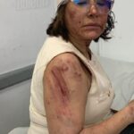 Presentadora Elianta Quintero entre los heridos por el colapso en la discoteca Jet Set